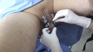 Unruly Patient Needle Pain Treatment (Rare)